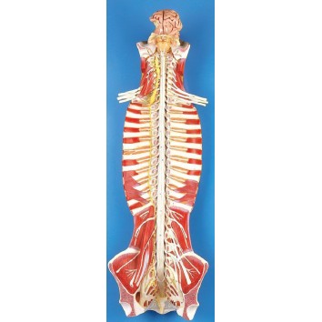 SPINAL CORD IN THE SPINAL CANAL (SOFT)